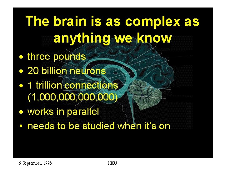 The brain is as complex as anything we know · three pounds · 20