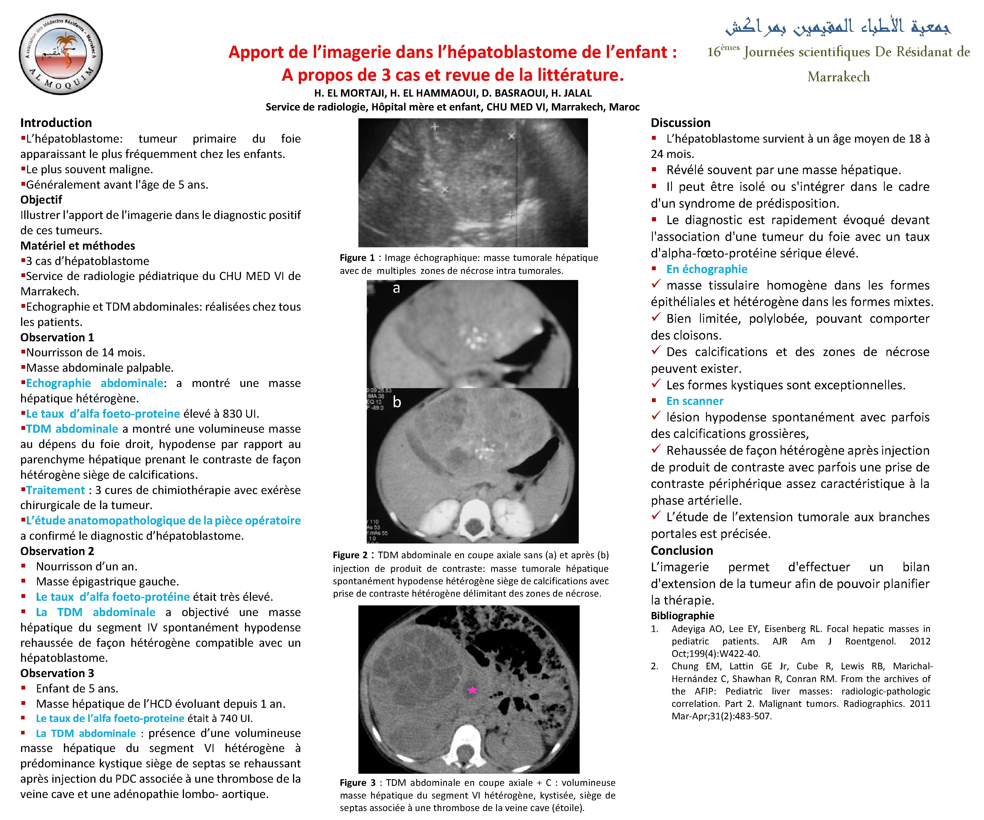 Apport de l’imagerie dans l’hépatoblastome de l’enfant : A propos de 3 cas et