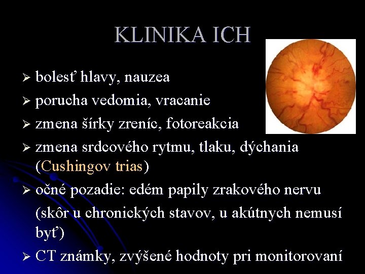 KLINIKA ICH Ø bolesť hlavy, nauzea Ø porucha vedomia, vracanie Ø zmena šírky zreníc,