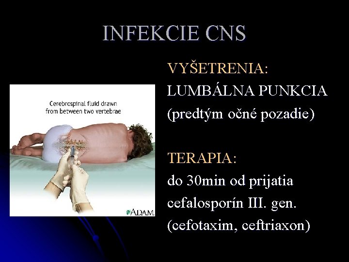 INFEKCIE CNS VYŠETRENIA: LUMBÁLNA PUNKCIA (predtým očné pozadie) TERAPIA: do 30 min od prijatia