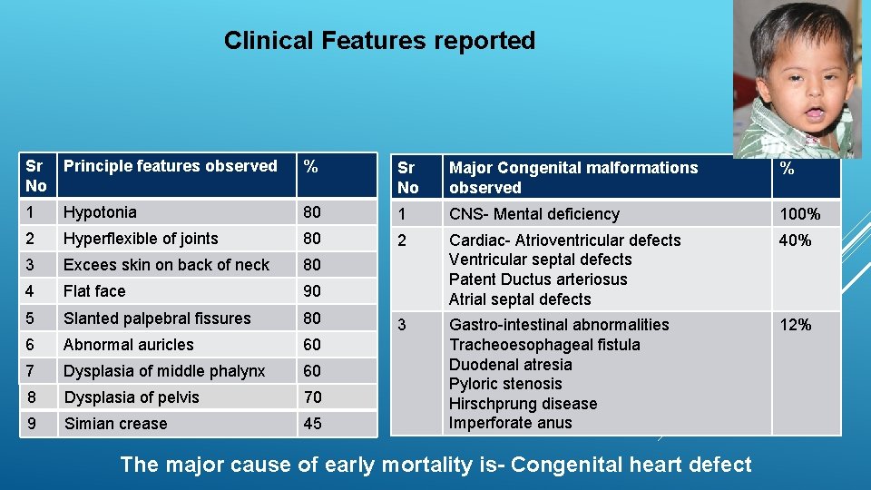 Clinical Features reported Sr Principle features observed No % Sr No Major Congenital malformations