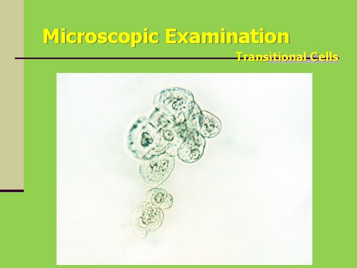 Microscopic Examination Transitional Cells 