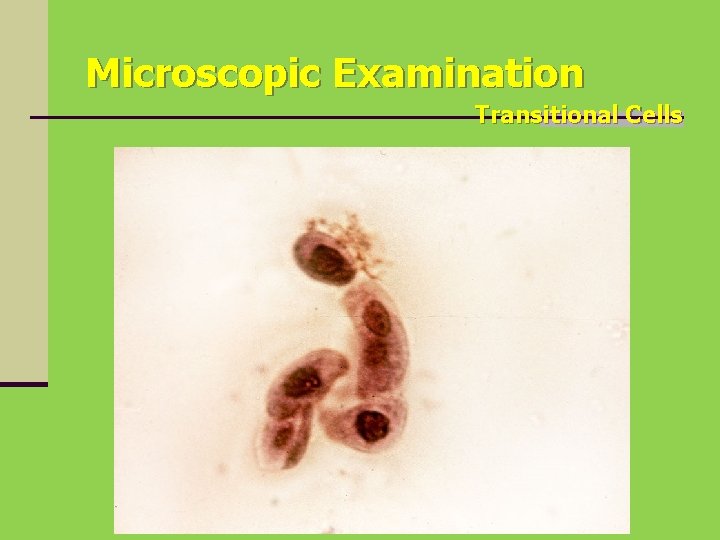 Microscopic Examination Transitional Cells 