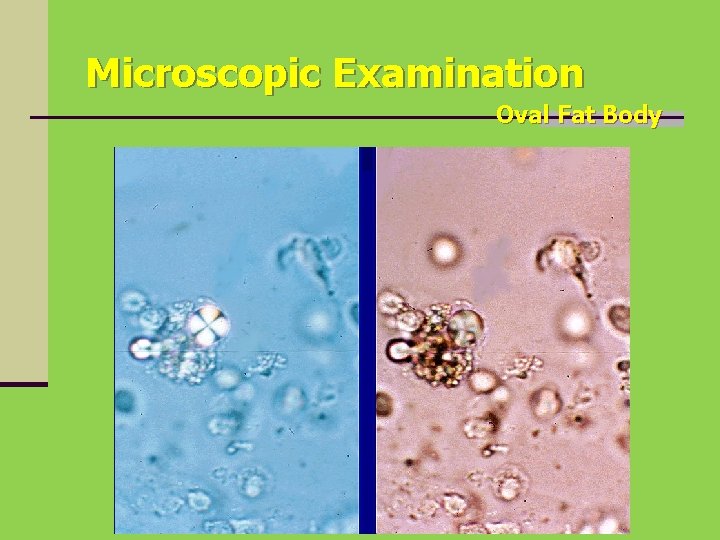 Microscopic Examination Oval Fat Body 