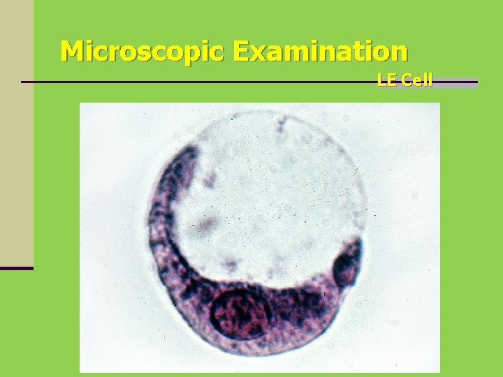 Microscopic Examination LE Cell 