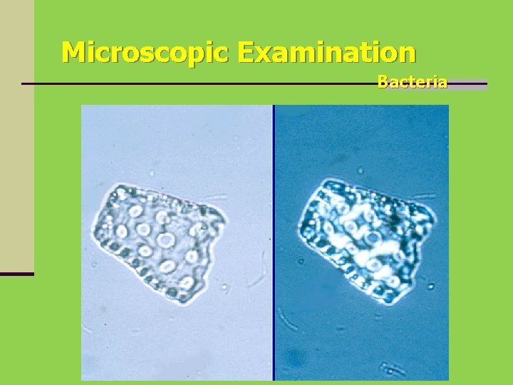 Microscopic Examination Bacteria 