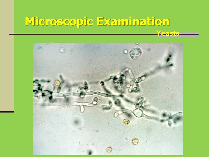 Microscopic Examination Yeasts 