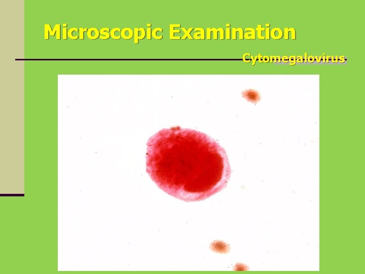 Microscopic Examination Cytomegalovirus 