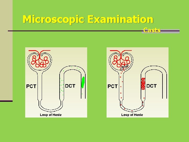 Microscopic Examination Casts 