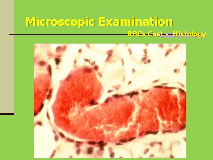 Microscopic Examination RBCs Cast - Histology 