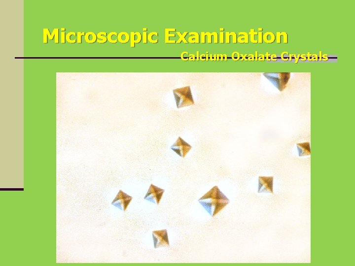 Microscopic Examination Calcium Oxalate Crystals 