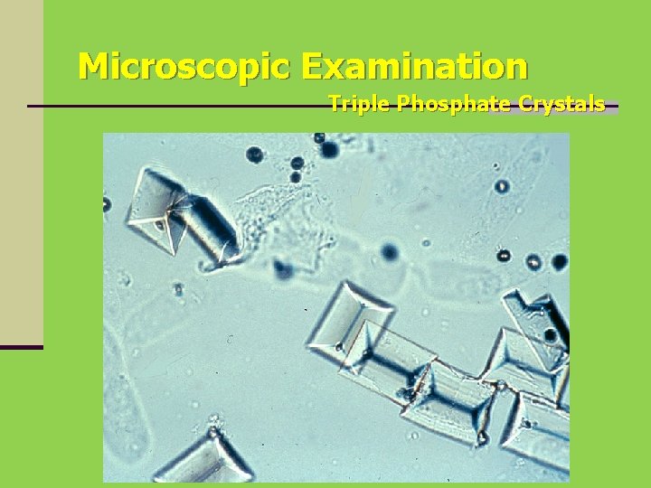 Microscopic Examination Triple Phosphate Crystals 