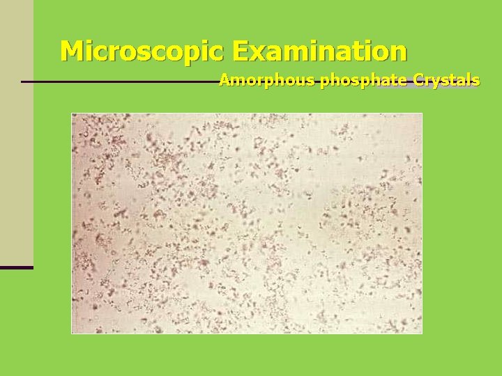 Microscopic Examination Amorphous phosphate Crystals 