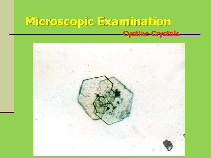 Microscopic Examination Cystine Crystals 