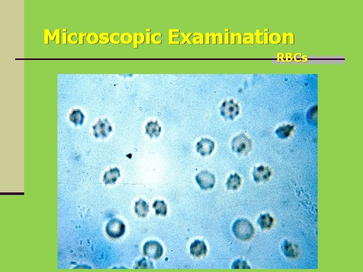 Microscopic Examination RBCs 