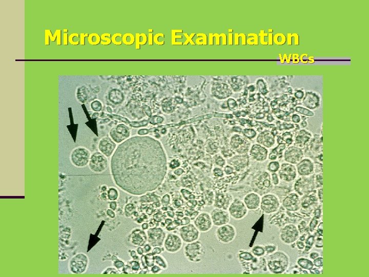 Microscopic Examination WBCs 