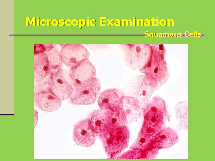 Microscopic Examination Squamous Cells 