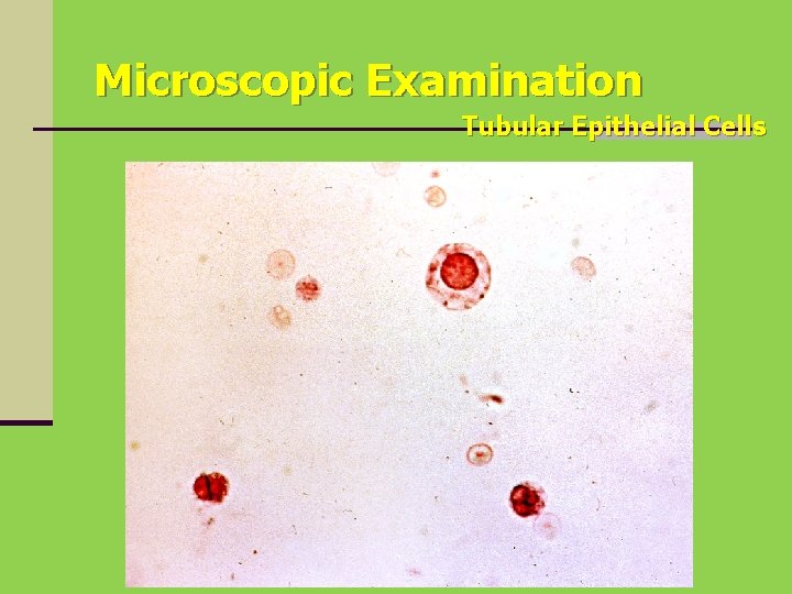 Microscopic Examination Tubular Epithelial Cells 