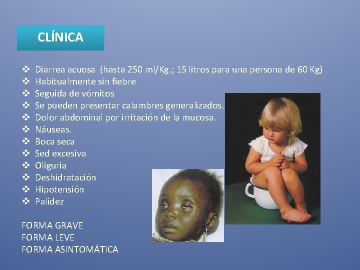 CLÍNICA v v v Diarrea acuosa (hasta 250 ml/Kg. ; 15 litros para una