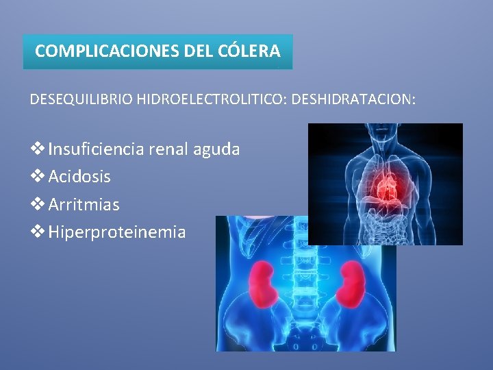 COMPLICACIONES DEL CÓLERA DESEQUILIBRIO HIDROELECTROLITICO: DESHIDRATACION: v Insuficiencia renal aguda v Acidosis v Arritmias