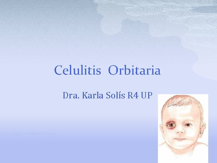 Celulitis Orbitaria Dra. Karla Solís R 4 UP 