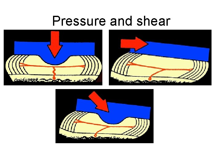 Pressure and shear 