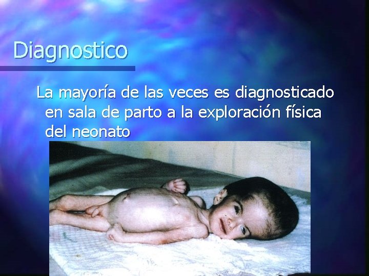 Diagnostico La mayoría de las veces es diagnosticado en sala de parto a la