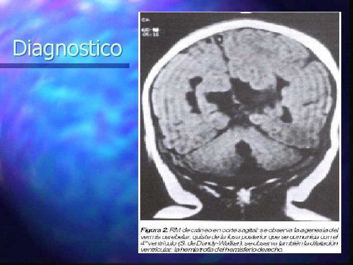 Diagnostico 