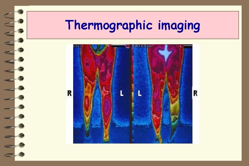 Thermographic imaging 