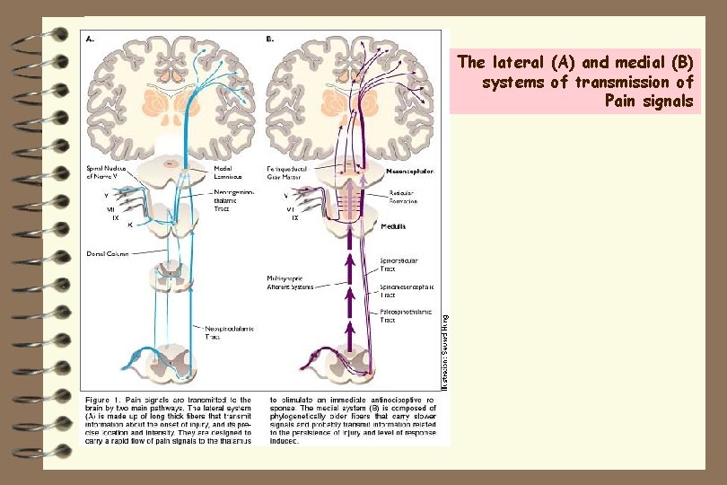 The lateral (A) and medial (B) systems of transmission of Pain signals 