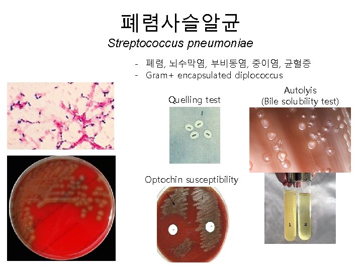 폐렴사슬알균 Streptococcus pneumoniae - 폐렴, 뇌수막염, 부비동염, 중이염, 균혈증 - Gram+ encapsulated diplococcus Quelling