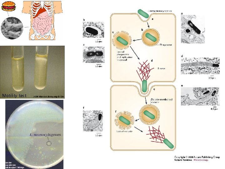 Motility test 