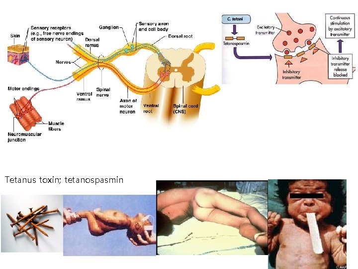 Tetanus toxin; tetanospasmin 