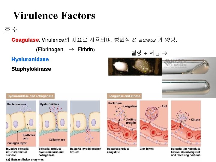 Virulence Factors 효소 Coagulase: Virulence의 지표로 사용되며, 병원성 S. aureus 가 양성. (Fibrinogen Hyaluronidase