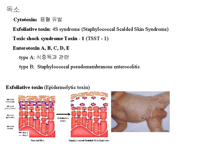 독소 Cytotoxin: 용혈 유발 Exfoliative toxin: 4 S syndrome (Staphylococcal Scalded Skin Syndrome) Toxic