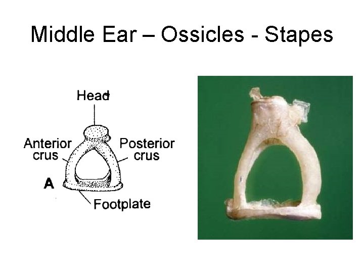 Middle Ear – Ossicles - Stapes 