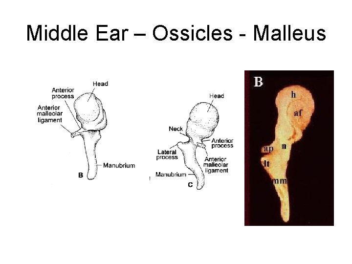 Middle Ear – Ossicles - Malleus 