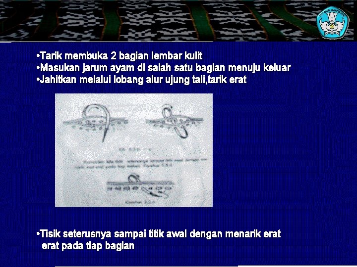  • Tarik membuka 2 bagian lembar kulit • Masukan jarum ayam di salah