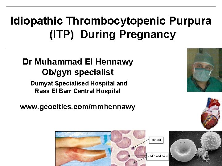 Idiopathic Thrombocytopenic Purpura (ITP) During Pregnancy Dr Muhammad El Hennawy Ob/gyn specialist Dumyat Specialised