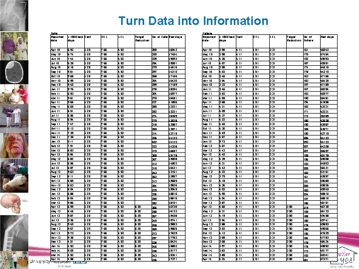 Turn Data into Information Falls Reported date x 1000 bed Cent days UCL LCL