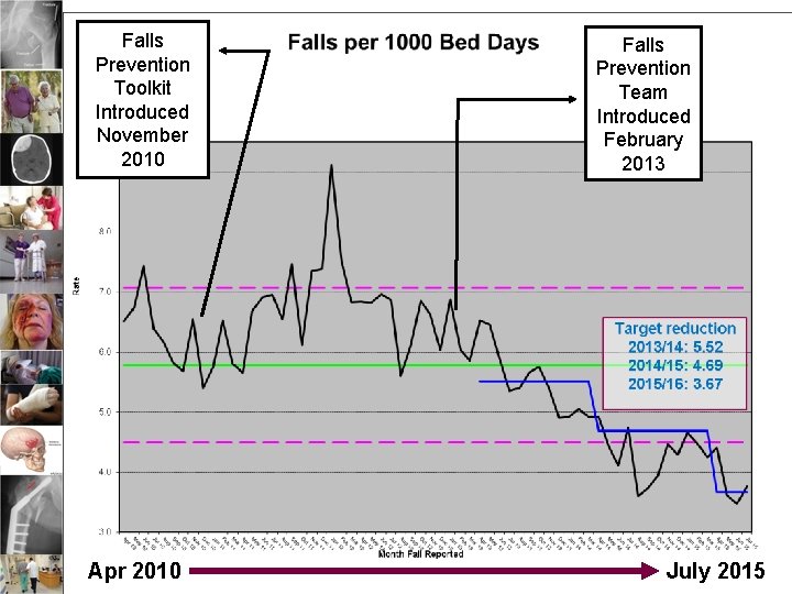 Falls Prevention Toolkit Introduced November 2010 Apr 2010 Falls Prevention Team Introduced February 2013