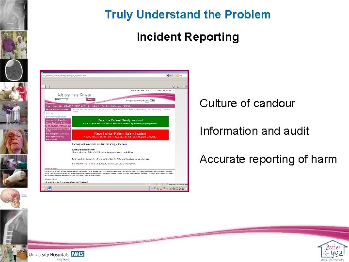 Truly Understand the Problem Incident Reporting Culture of candour Information and audit Accurate reporting