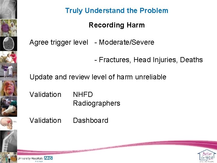 Truly Understand the Problem Recording Harm Agree trigger level - Moderate/Severe - Fractures, Head