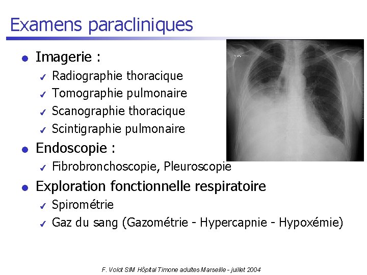 Examens paracliniques l Imagerie : 4 4 l Endoscopie : 4 l Radiographie thoracique