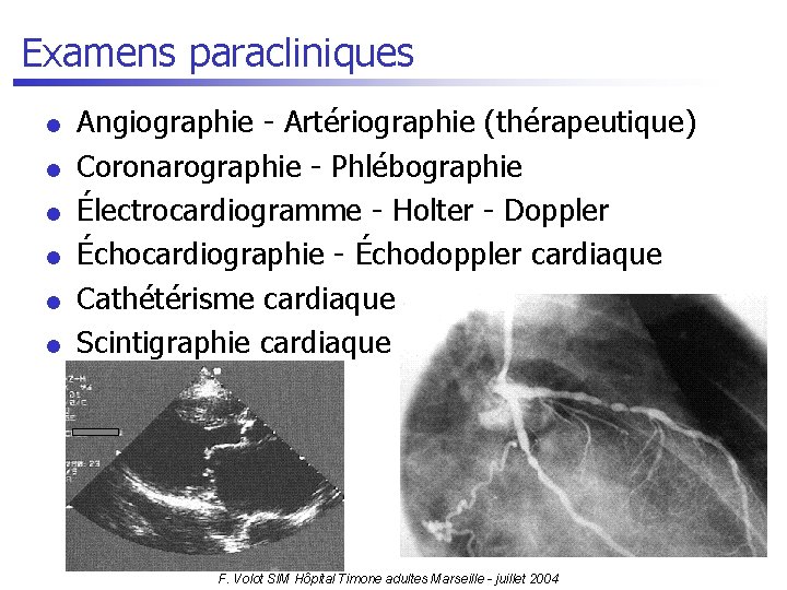 Examens paracliniques l l l Angiographie - Artériographie (thérapeutique) Coronarographie - Phlébographie Électrocardiogramme -