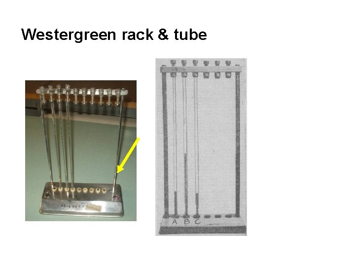 Westergreen rack & tube 