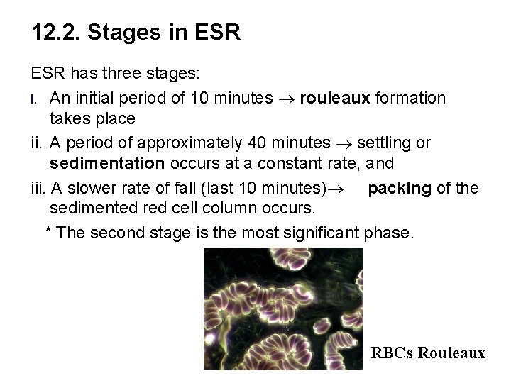 12. 2. Stages in ESR has three stages: i. An initial period of 10