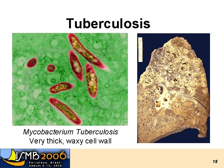 Tuberculosis Mycobacterium Tuberculosis Very thick, waxy cell wall 18 Tuberculosis Mycobacterium Tuberculosis Very thick, waxy cell wall 18