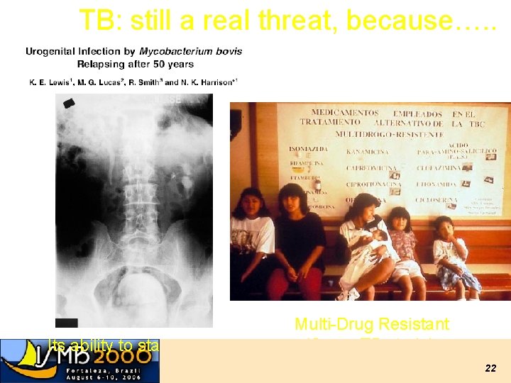 TB: still a real threat, because…. . Its ability to stay alive Multi-Drug Resistant TB: still a real threat, because…. . Its ability to stay alive Multi-Drug Resistant