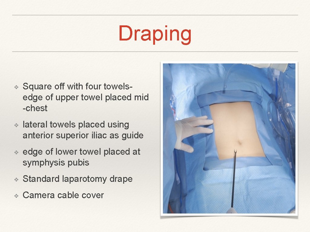 Draping ❖ Square off with four towelsedge of upper towel placed mid -chest ❖